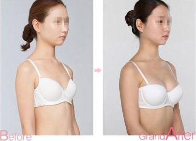 成都祛斑醫(yī)院排名前八，告訴你哪家靠譜