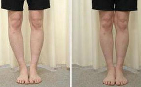 如何使用蜂蜜進(jìn)行減肥？有效嗎？