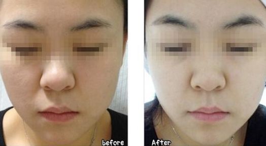 合肥哪些整形醫(yī)院名氣最大？