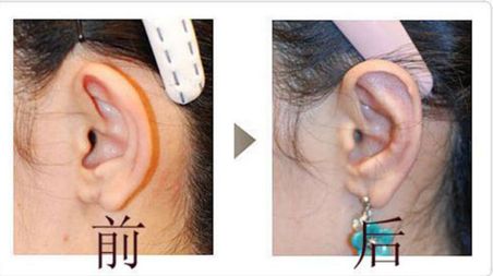 合肥華美美容醫(yī)院 綜合評(píng)價(jià)與技術(shù)實(shí)力分享