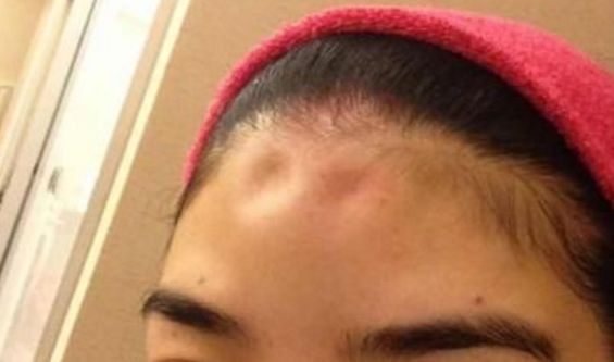 關(guān)于眼部整形醫(yī)院的最新動態(tài)