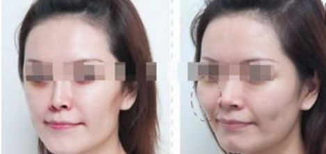 杭州整形美容醫(yī)院排名前六，你值得了解的每一家！