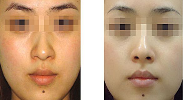 青島市城陽區(qū)吸脂整形醫(yī)院哪家好，用戶評(píng)價(jià)排名前三