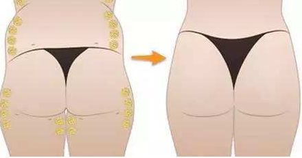 北京雙眼皮價格大全，口碑醫(yī)生推薦，預(yù)約指南