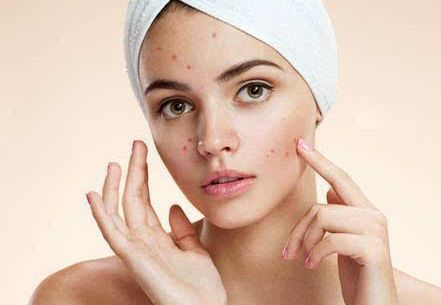 青島哪家植發(fā)醫(yī)院好？諾美德、興尚、熙朵毛發(fā)移植推薦