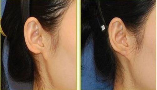 大慶拉皮手術(shù)好口碑醫(yī)院推薦：用戶真實(shí)評(píng)價(jià)分享！