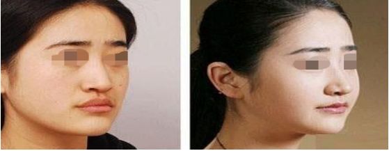 昆明哪家整形醫(yī)院好評較多的名單大揭秘