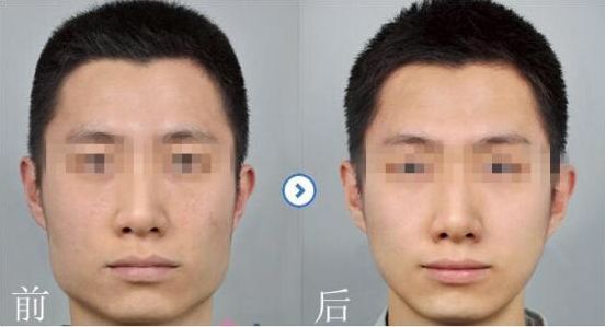 2024寧波注射自體脂肪醫(yī)院排行榜，就在這里發(fā)現(xiàn)比較好的選擇！