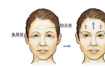 南京哪家醫(yī)院專業(yè)去痣效果好