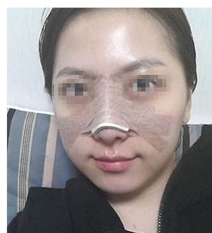 長(zhǎng)春哪家醫(yī)療機(jī)構(gòu)技術(shù)受認(rèn)可，雙眼皮整形實(shí)效較顯著