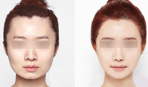 西安藝星醫(yī)療美容醫(yī)院2023年價格一覽：了解醫(yī)療美容服務費用信息，醫(yī)生簡介待查！