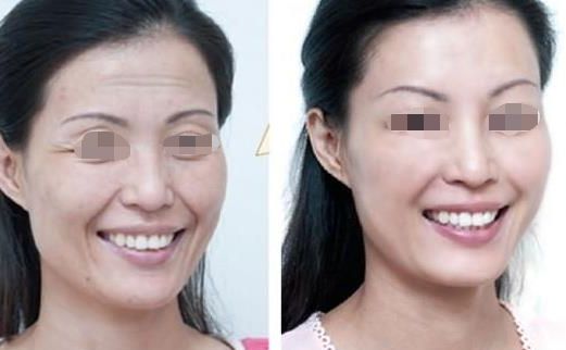 深圳整形業(yè)內(nèi)領(lǐng)導(dǎo)的三家醫(yī)院排行榜