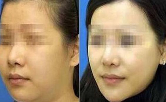 西昌愛麗諾醫(yī)療整形美容醫(yī)院綜合實力如何