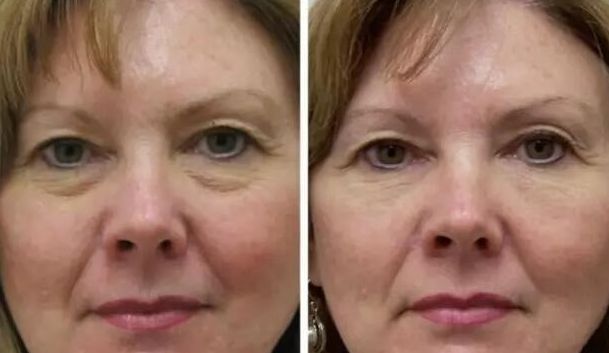 浙江哪家整形醫(yī)院是三甲醫(yī)院