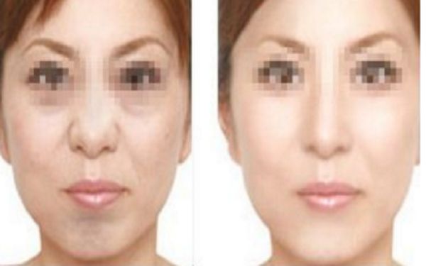 惠州整容醫(yī)院評價top10