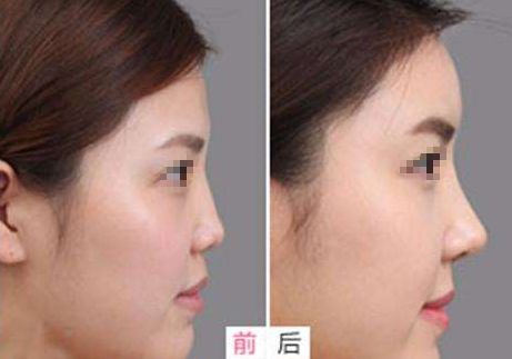 重慶小柯麗格口碑揭秘：權(quán)威機構(gòu)認證，美麗蛻變首選