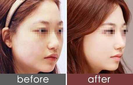 貴陽美萊黃金元美膚三周年特惠：特價套餐￥8800元！