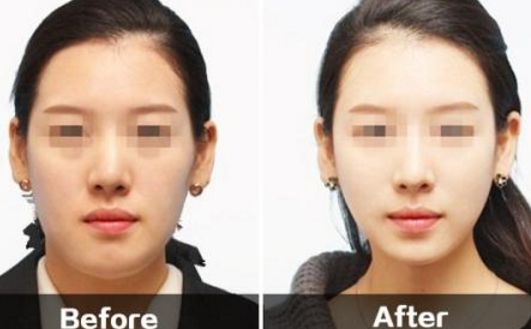 福州名韓和華美對(duì)比：口碑、項(xiàng)目一覽