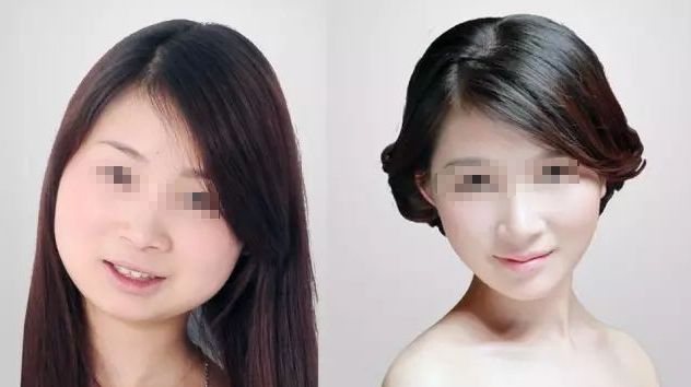 成都藝星何林：打造自然大方雙眼皮，3位顧客口碑爆棚