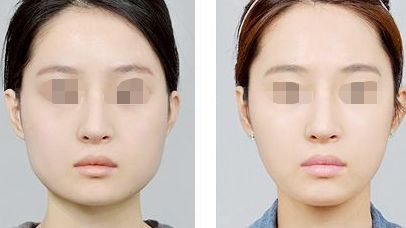 濟(jì)南市優(yōu)質(zhì)隆鼻醫(yī)院排行榜一覽