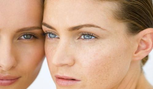 廈門哪個醫(yī)院可以做雙眼皮整形手術(shù)？