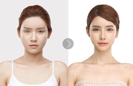 合肥激光祛斑哪家好？藝星激光專業(yè)祛斑，價(jià)格親民有保障