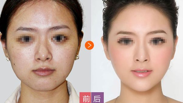 邢臺(tái)博愛高健整容致命嗎？高健整容水平值得信賴！