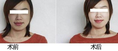 重慶時(shí)光整形美容醫(yī)院解析：專業(yè)實(shí)力口碑好，名醫(yī)薈萃信賴之選