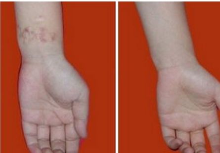 邯鄲市人民醫(yī)院整形科：2023年價(jià)目公示，獨(dú)特服務(wù)一覽