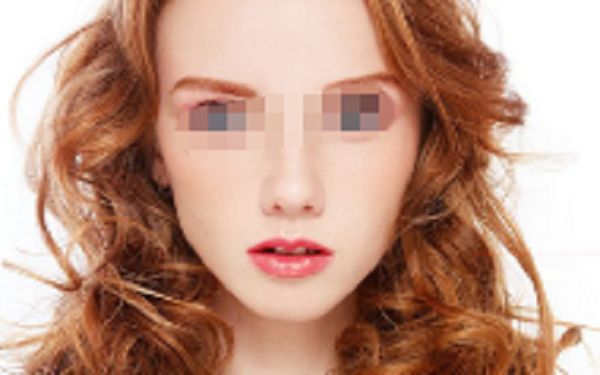 衢州哪家醫(yī)院割雙眼皮效果好？