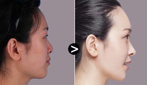 西安哪家整形醫(yī)院匯總排名前十？專業(yè)權(quán)威醫(yī)院推薦！