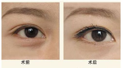 鄭州整形醫(yī)院排名前三，手術(shù)技術(shù)領(lǐng)先無需出差！