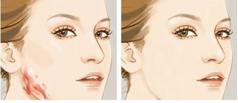 青島城陽區(qū)哪家醫(yī)院做吸脂整形好