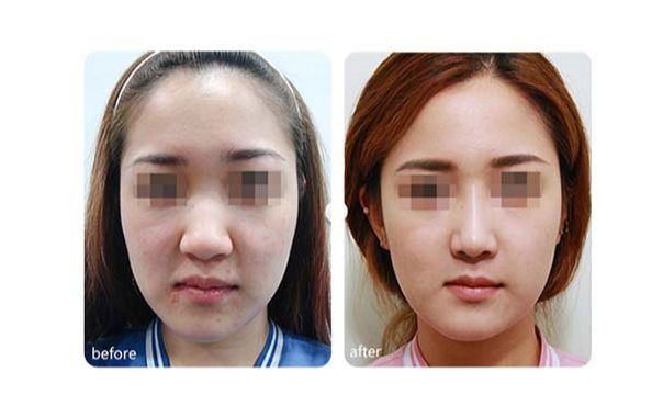 廣州優(yōu)質磨骨整形醫(yī)院推薦！TOP10醫(yī)療機構揭秘