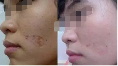 無(wú)錫哪家醫(yī)院的美容效果好