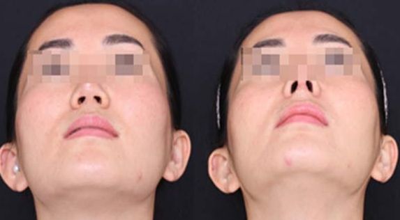 重慶哪家整形醫(yī)院口碑好？專業(yè)整形醫(yī)院推薦匯總