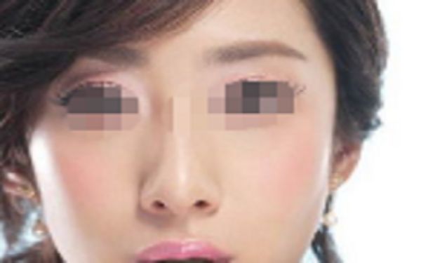 蘇州祛斑整形醫(yī)院哪家好？點擊查看排名前四家醫(yī)院名單！