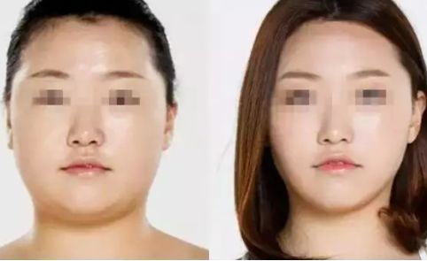 選擇合適的烏魯木齊鼻整機構(gòu)，幫助你實現(xiàn)理想鼻形