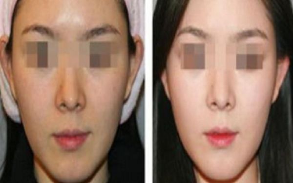 銅陵博愛醫(yī)院醫(yī)療美容科，專業(yè)醫(yī)生技術如何？