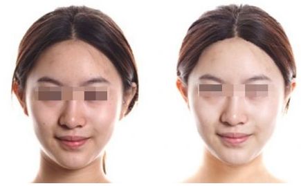 青島去疤醫(yī)院排行榜一覽：全面評(píng)估了該市最佳治療疤痕的醫(yī)院