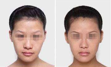 沙醫(yī)生整形大連收費揭秘！院內(nèi)價格表詳解，看看整形費用是否貴？