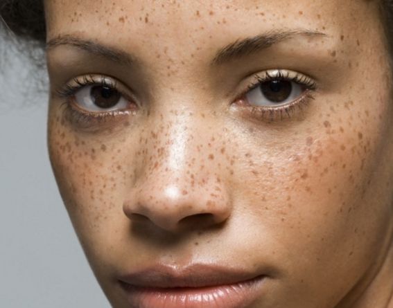 北京雙眼皮手術(shù)哪家醫(yī)院好？專業(yè)推薦前三名