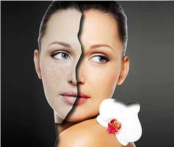 微拉美和埋線提升術(shù)，價格及效果大比拼!