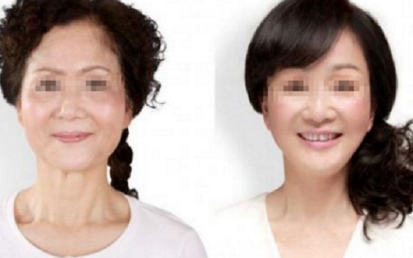 北京脫毛技術(shù)哪家醫(yī)院可靠？