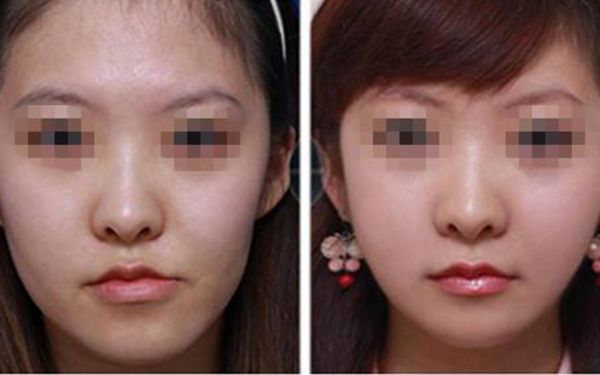 【2024】西安微整形醫(yī)院哪家好？排行榜大揭秘！