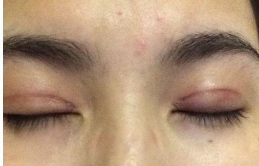 2024年臺州市頂尖整形醫(yī)院排行榜發(fā)布，震撼推薦臺州名列前茅的醫(yī)療機構！