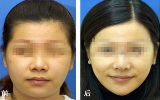 廣東美恩整形美容醫(yī)院口碑揭秘：地址、醫(yī)生評價指南