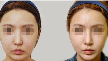 2024年濰坊市整形醫(yī)院綜合評價