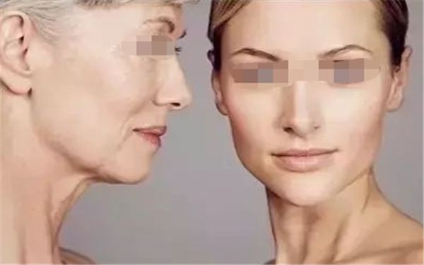 南京哪家整形醫(yī)院豐胸效果好