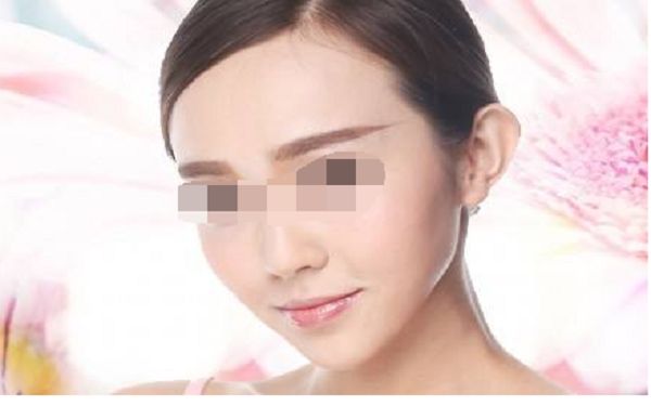 北京碧蓮盛發(fā)際線種植技術(shù)怎么樣？